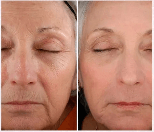Crema Antiedad Premium Duo